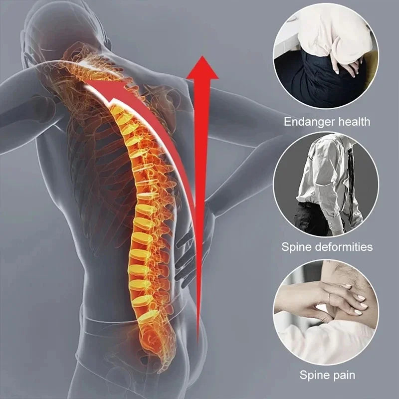 Adjustable Posture Corrector Back Brace Orthopedic Spine Support For Men Women Hunchback Scoliosis Correction Back Straightener